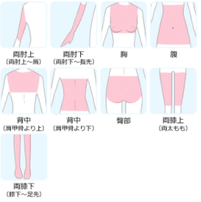 Lパーツ脱毛料金